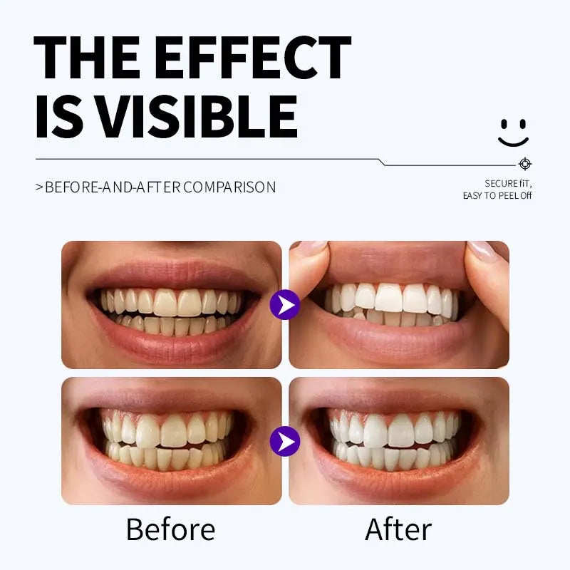 Dr. Dent Smile Purple Teeth Whitening Strips