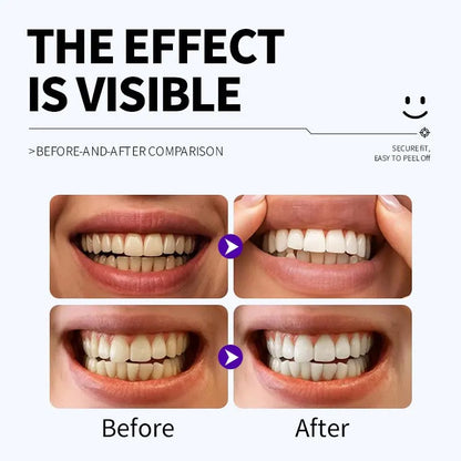Dr. Dent Smile Purple Teeth Whitening Strips